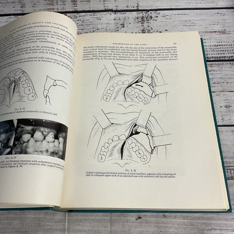 Plastic Surgery In Infancy And Childhood John Clark Mustarde Hardcover Book