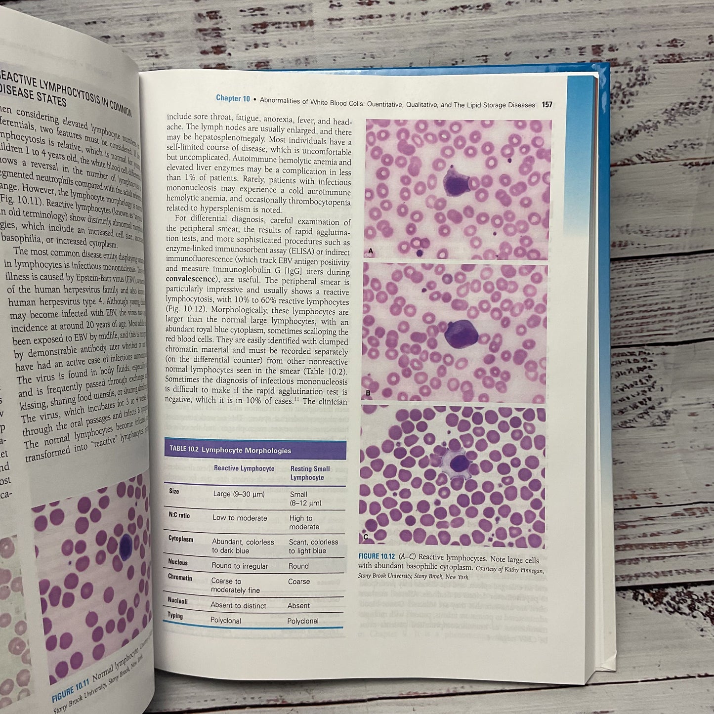Hematology In Practice Betty Ciesla Third 3rd Edition Hardcover