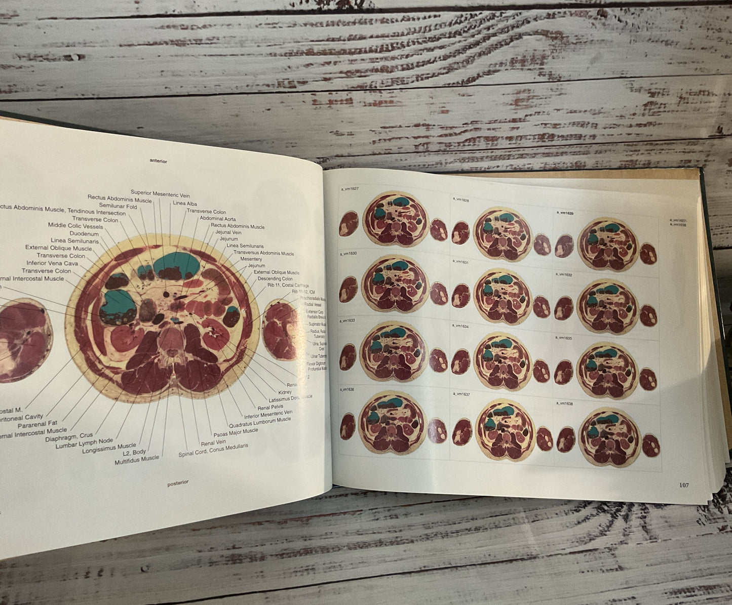 National Library of Medicine Atlas of The Visible Human Male