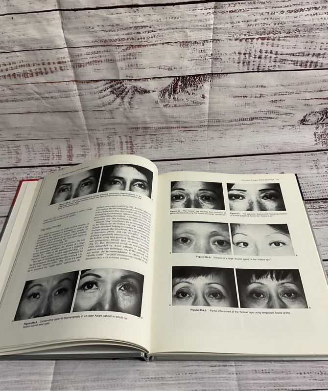 Cosmetic Surgery Of The Asian Face By John A. McCurdy Jr. 1990 Hardcover